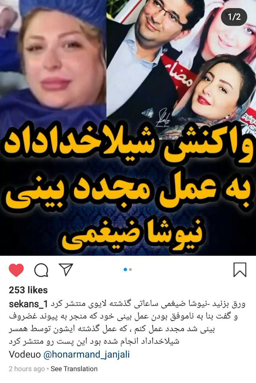 همسر شیلا خداداد پیوند غضروف بینی شیلا خداد