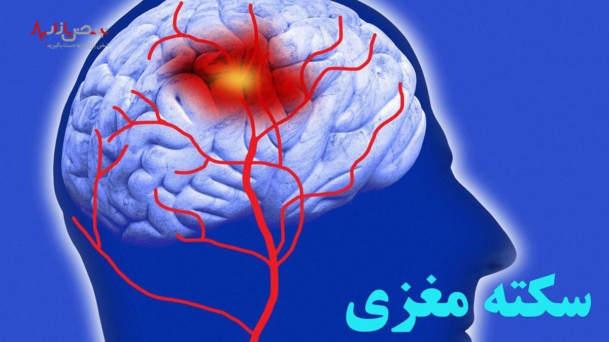 کاهش خطر سکته مغزی با دو داروی رایج