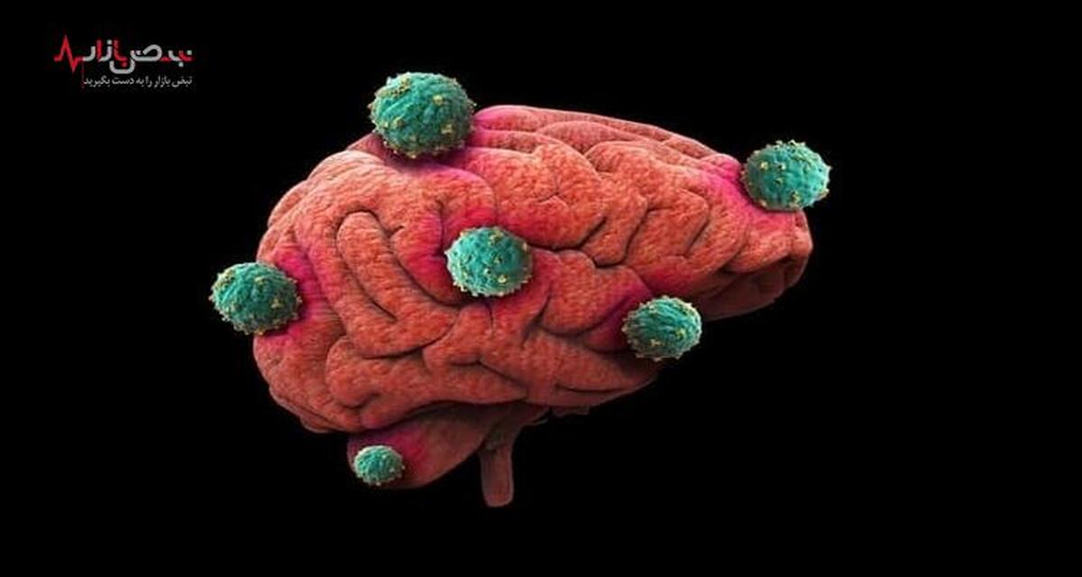 رازهای پنهان تومور مغزی که دکترها به شما نمی‌گویند